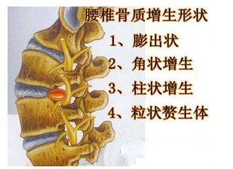 QQ截图20160305092305.png